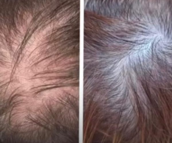 hair_ba2_clean